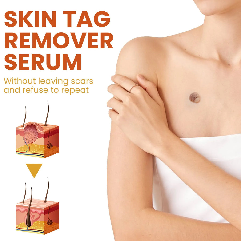 Cleansing skin wart fading mole solution in 15ml plastic bottle with dimensions 2.5 x 2.5 x 7cm