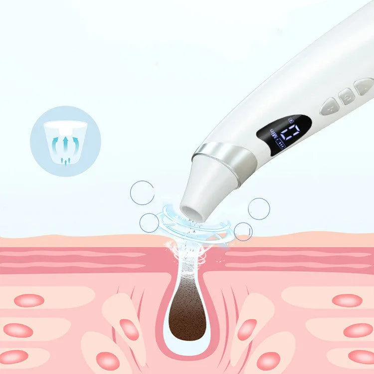 White electric visual blackhead suction instrument with LED display, four silicone heads, and USB charging cable on a sponge bag.