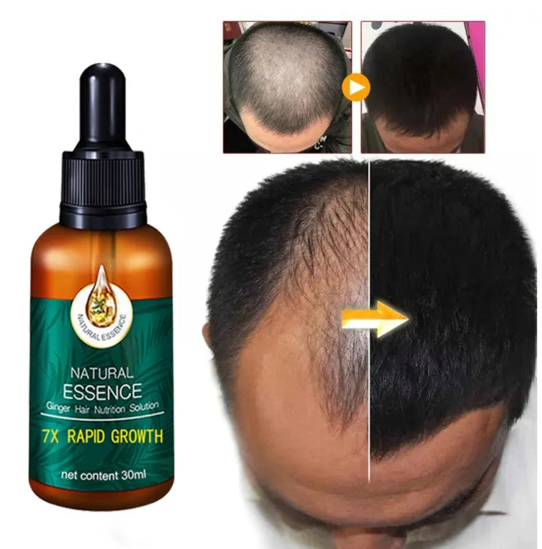 30ml hair growth essential oil bottle for men and women, natural follicle repair serum for thin fragile hair
