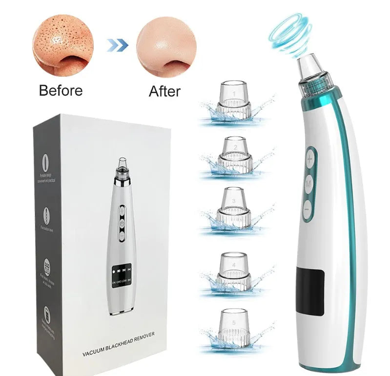 Black electric blackhead suction instrument, 173x44x40mm, 133g, with USB charging and five gears.