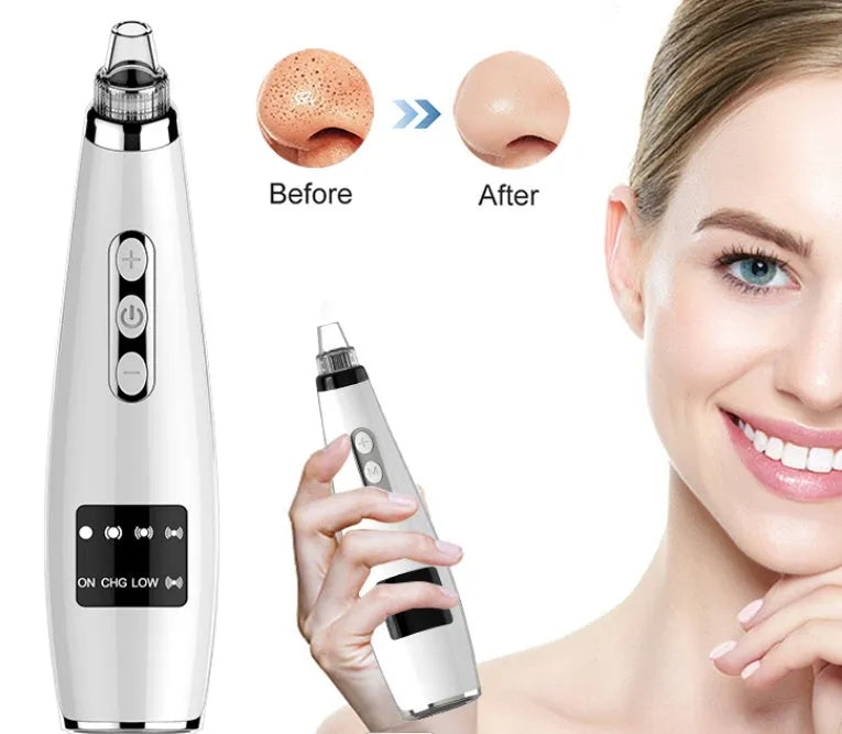 Black electric blackhead suction instrument, 173x44x40mm, 133g, with USB charging and five gears.