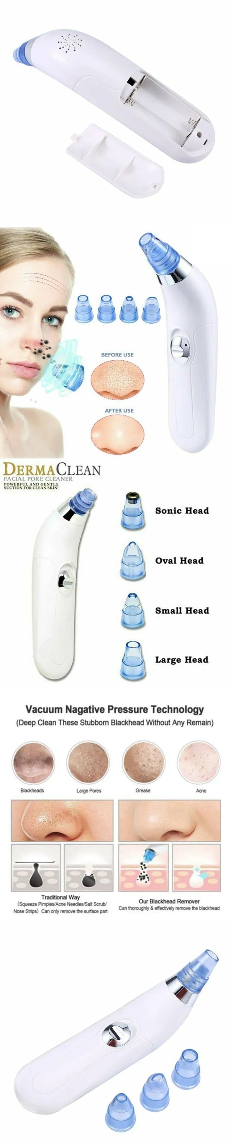 Electric pore cleaner with ultrasonic vibration, white and pink colour options for blackhead removal