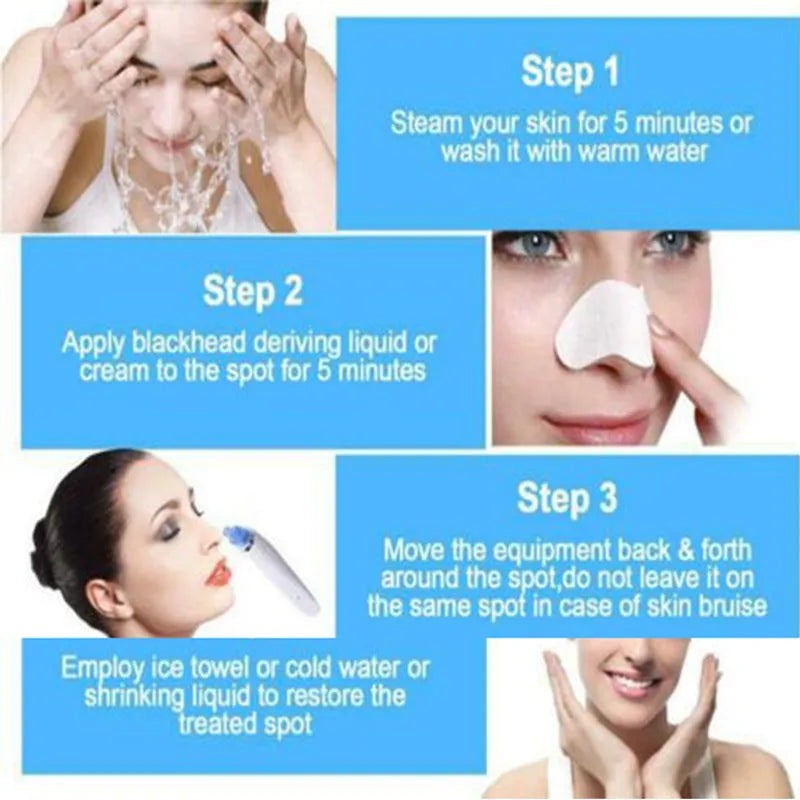 Electric pore cleaner with ultrasonic vibration, white and pink colour options for blackhead removal
