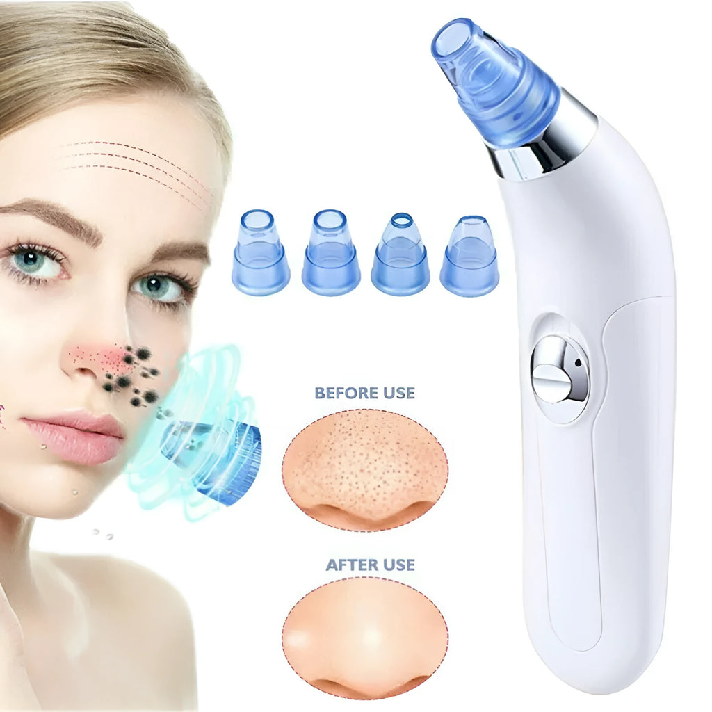 Electric pore cleaner with ultrasonic vibration, white and pink colour options for blackhead removal