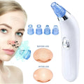 Electric pore cleaner with ultrasonic vibration, white and pink colour options for blackhead removal