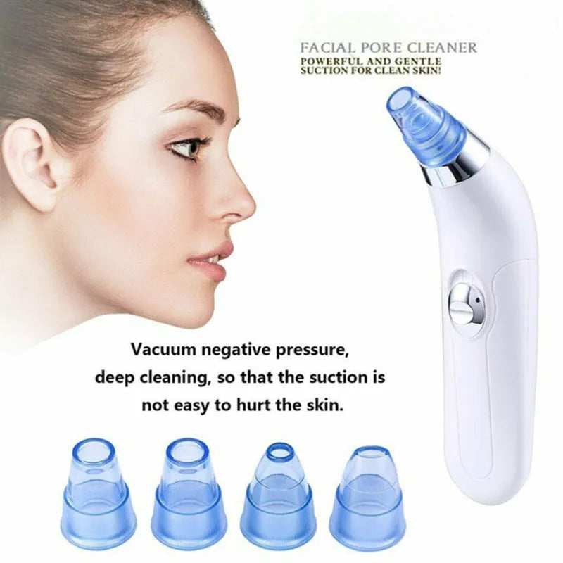 Electric pore cleaner with ultrasonic vibration, white and pink colour options for blackhead removal