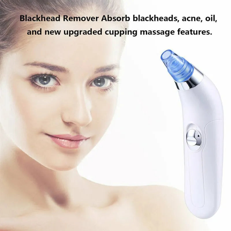 Electric pore cleaner with ultrasonic vibration, white and pink colour options for blackhead removal