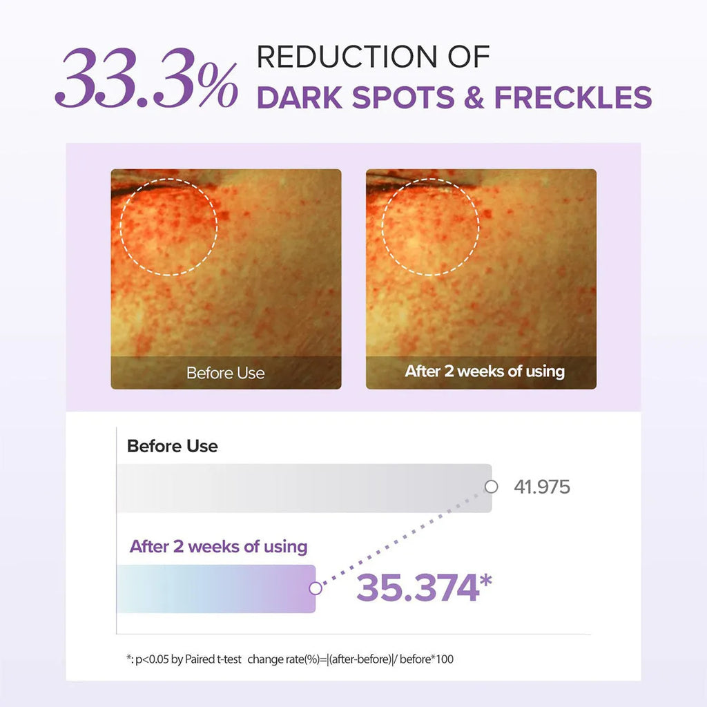 Moisturising and blackening eye neck cream 30ml standard specifications for dark circles