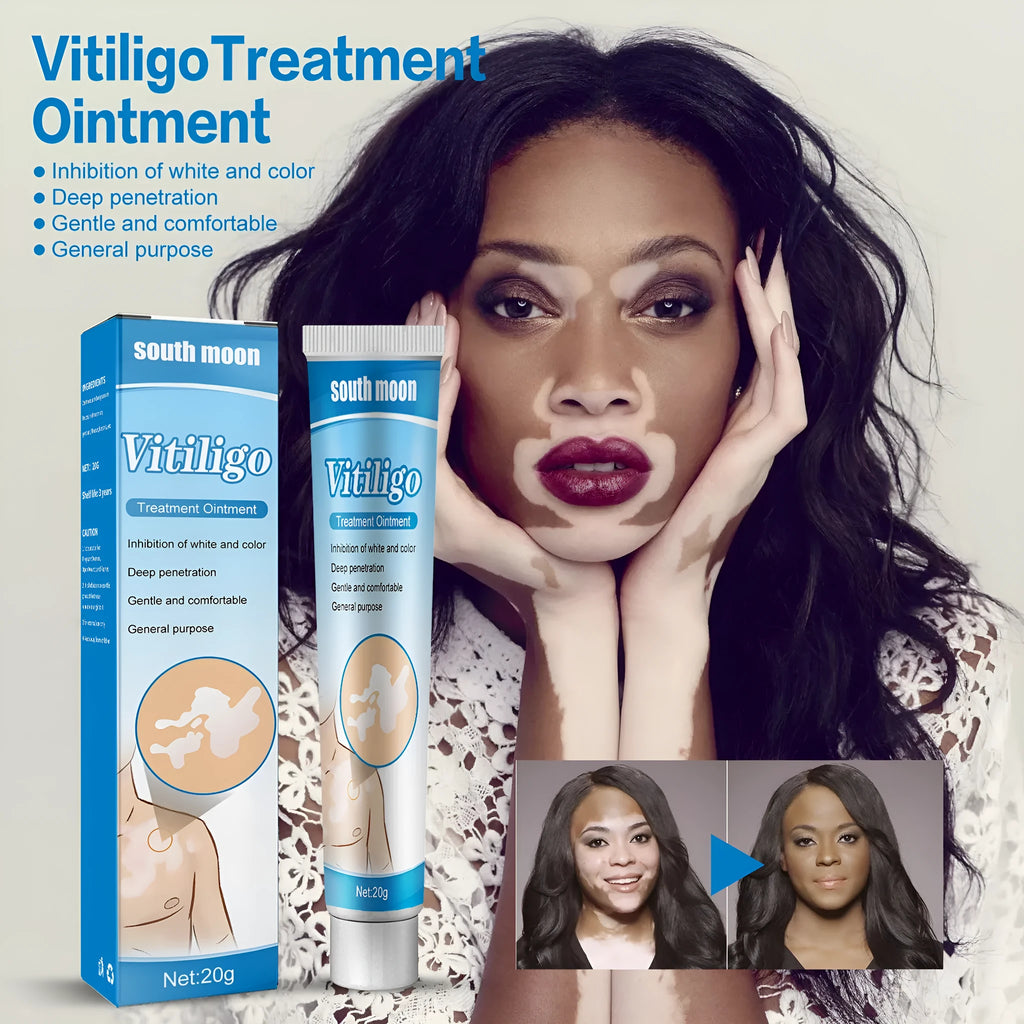 Flower Spot Sweat Spot Cream 20g white cream in box packaging for targeted blemish treatment