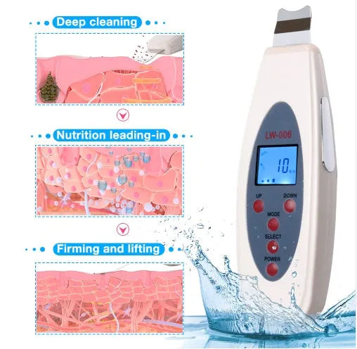White ultrasonic skin cleaner with 28000Hz vibration and mild heating for blackhead removal