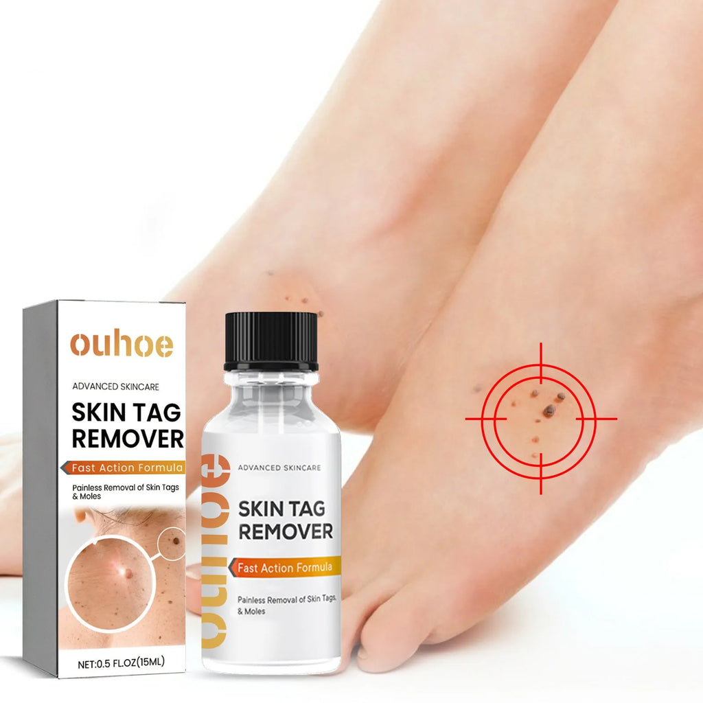 Cleansing skin wart fading mole solution in 15ml plastic bottle with dimensions 2.5 x 2.5 x 7cm
