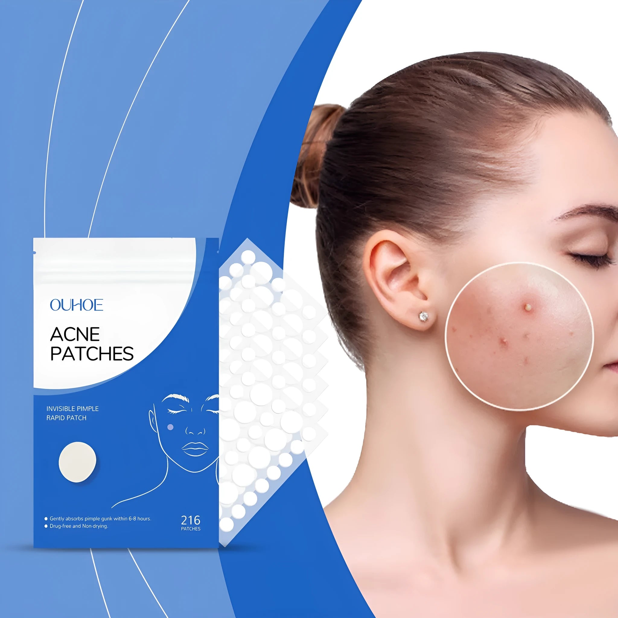 Acne patches with tea tree oil and vitamin E in 216-piece pack