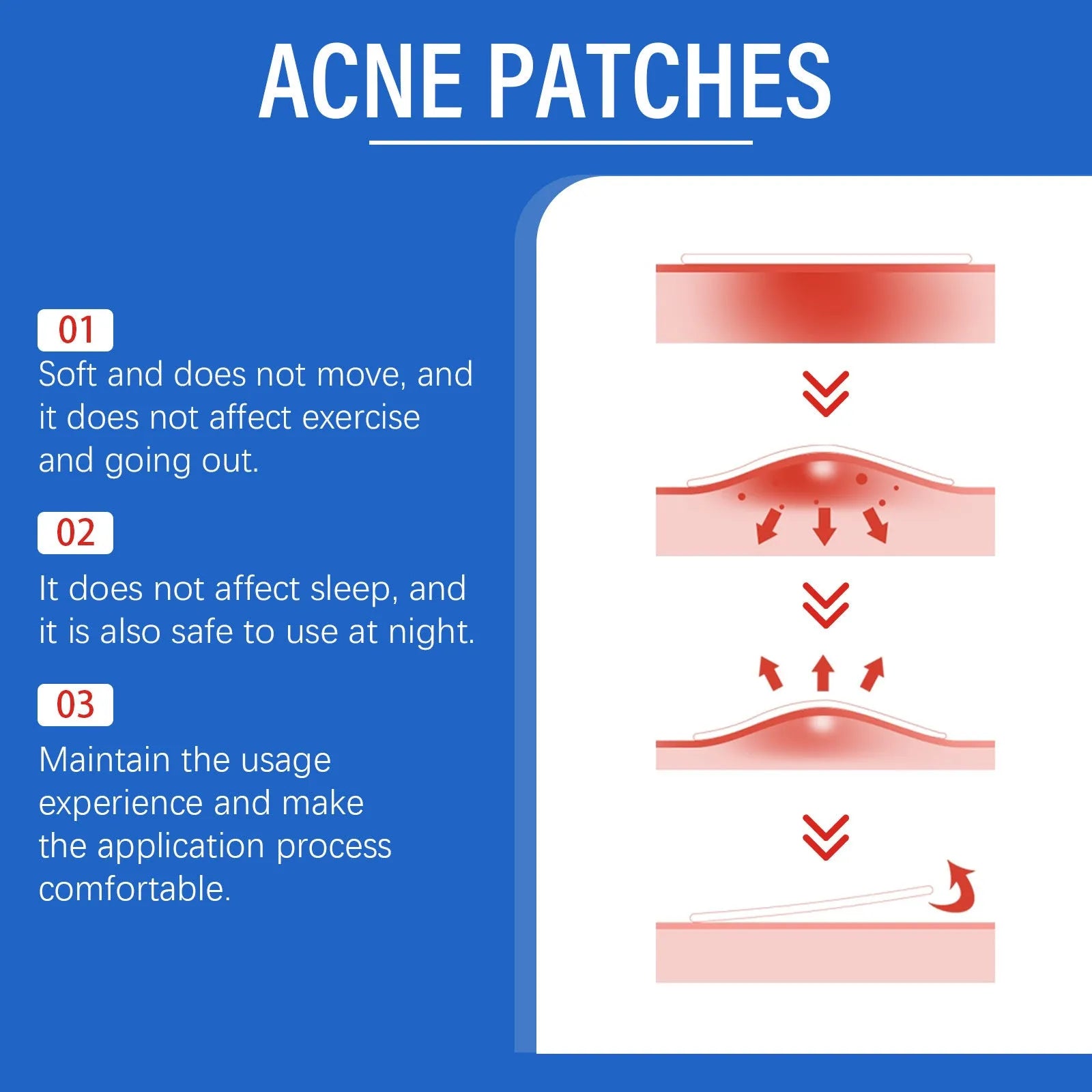 Acne patches with tea tree oil and vitamin E in 216-piece pack