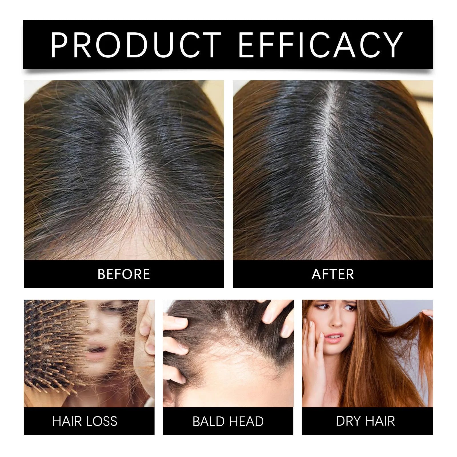 Marjoran Mi Hair Oil 30ml bottle with marjoram and rosemary extract formula for dry hair
