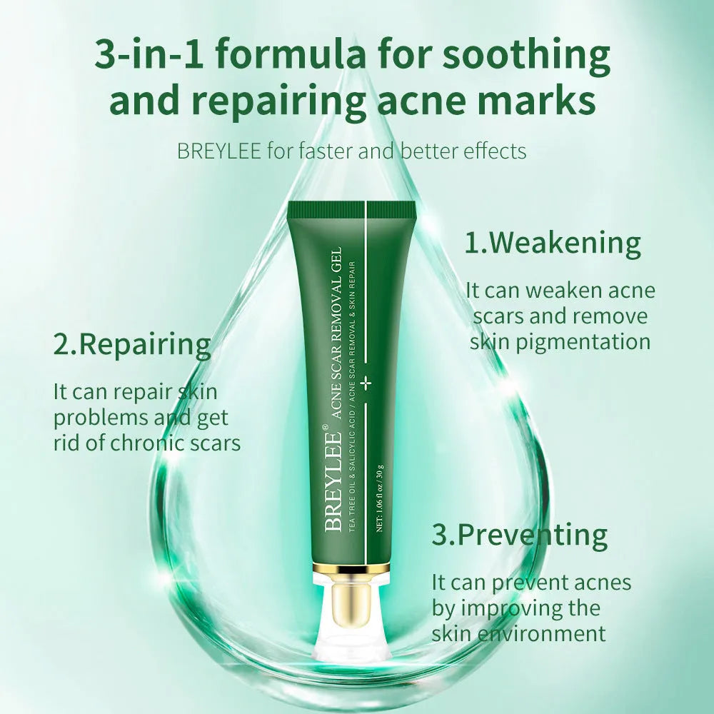 Green tube of acne scar removal gel with tea tree oil, 30g size, on white background