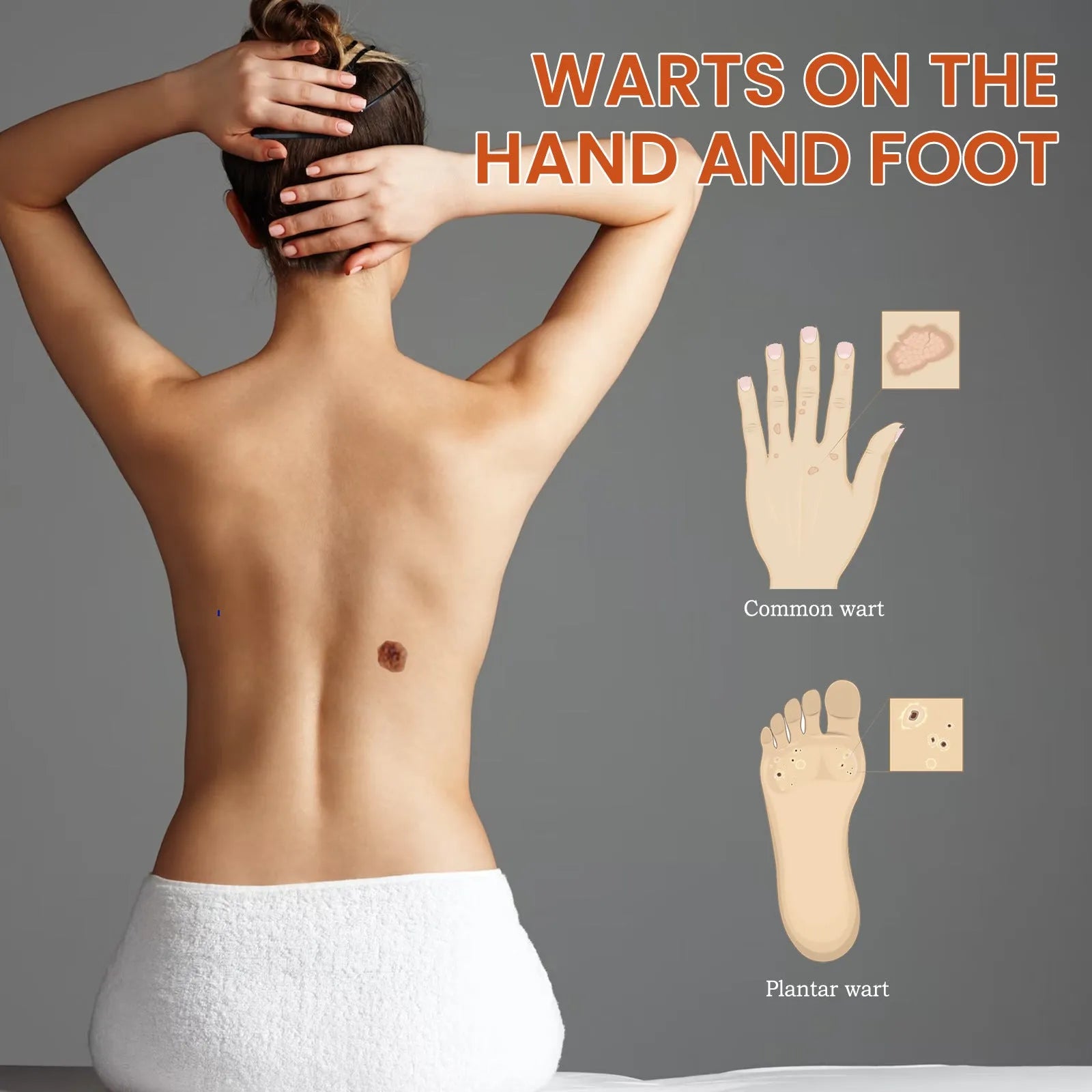 Cleansing skin wart fading mole solution in 15ml plastic bottle with dimensions 2.5 x 2.5 x 7cm