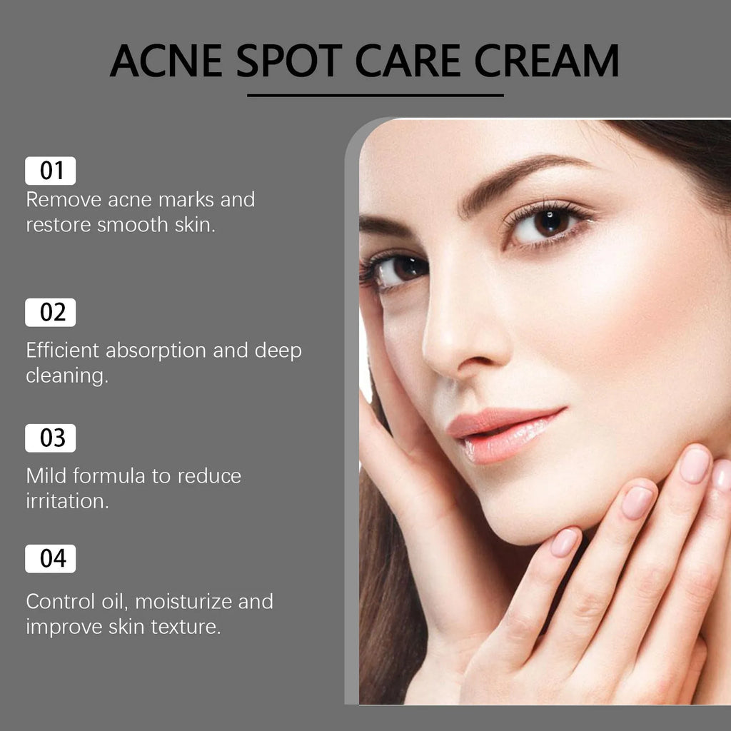 15g tube of hydrating acne cream with mint leaf, tea tree oil and aloe leaf ingredients
