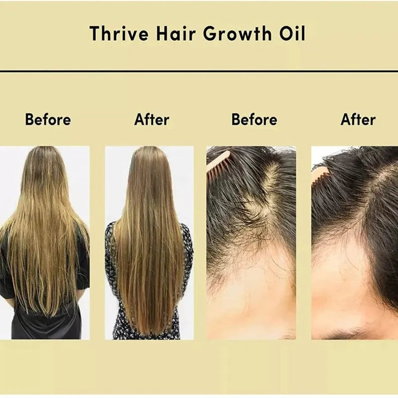 Yellow rosemary essential oil in 60ml bottle for hair care treatment