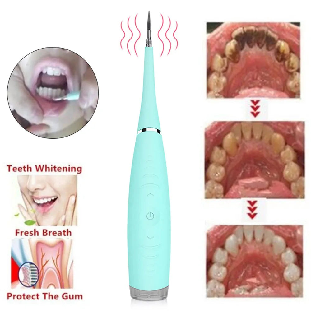 Pink and blue waterproof electric dental scaler with silicone handle and charging cable on a bathroom counter.