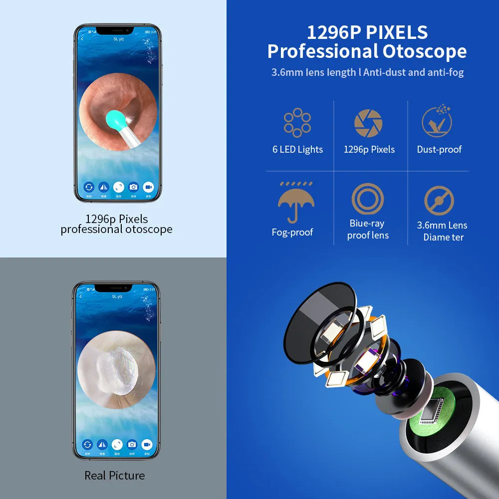 NE3 wireless otoscope ear cleaner with camera, LED light, and spoon heads on a white background.